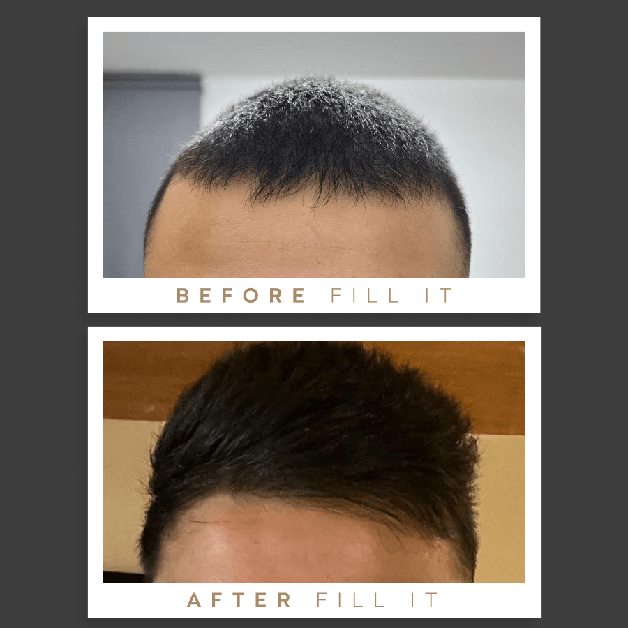 Fill it men hair complex - Fill it Vitamins