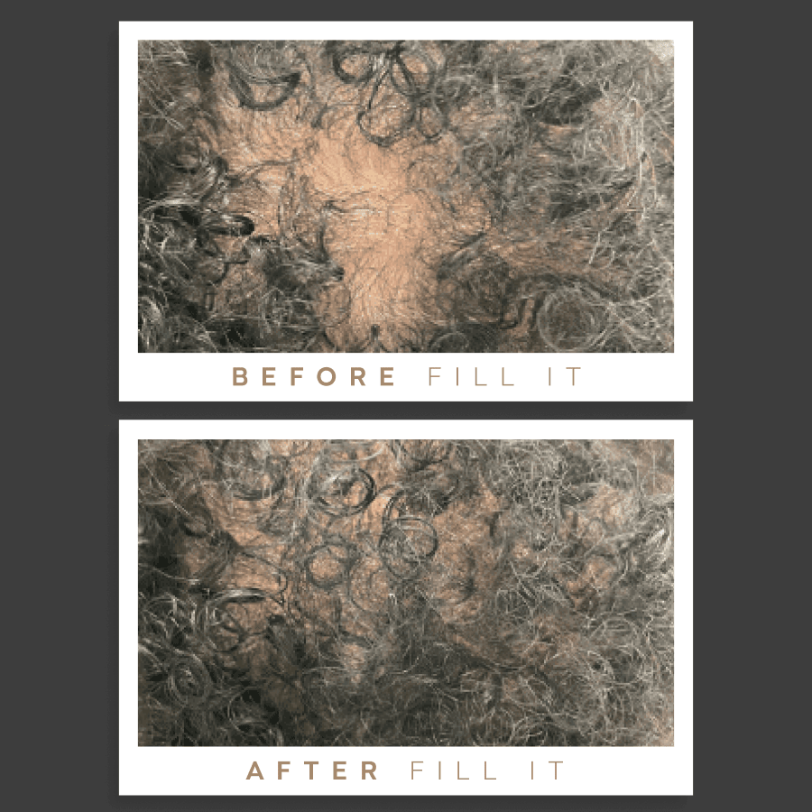 Fill it men hair complex - Fill it Vitamins