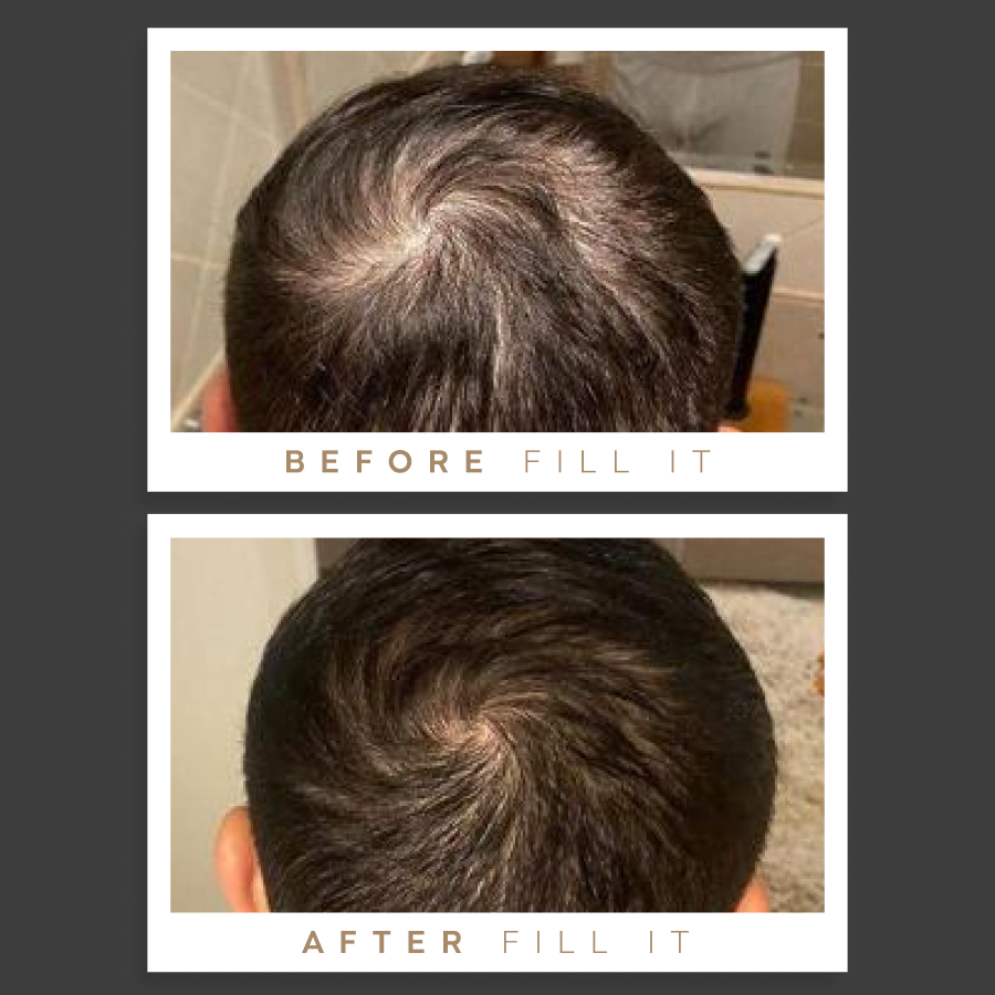Fill It FILLIT MEN HAIR COMPLEX: תוסף תזונה פיל איט לגברים לחיזוק השיער | Fill It