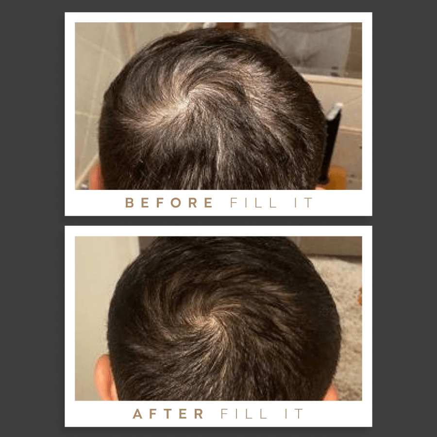Fill it men hair complex - Fill it Vitamins