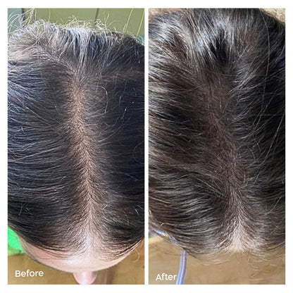 Fill it women hair complex