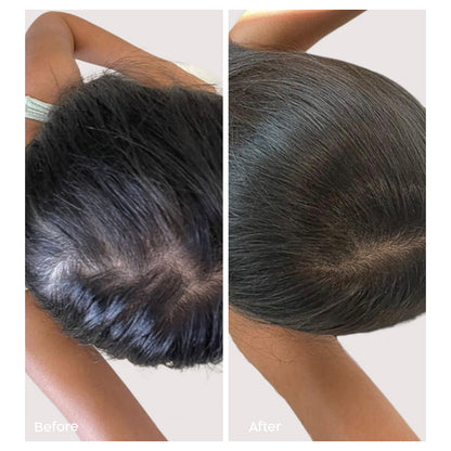 Fill it women hair complex