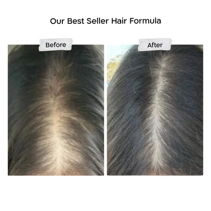 Fill it women hair complex
